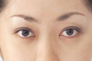 高い人気を呼んでいるボトックス注射について