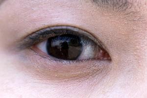 薄いお尻をボリュームアップしたい場合には