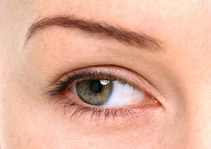 アザの解消にレーザー治療が適切か